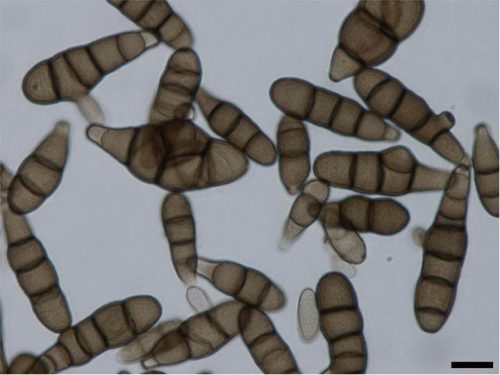recognize spores of fungus Alternaria brassicae