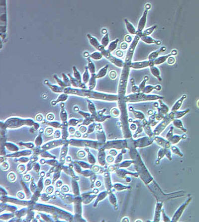 recognize spores of trichoderma harzianum